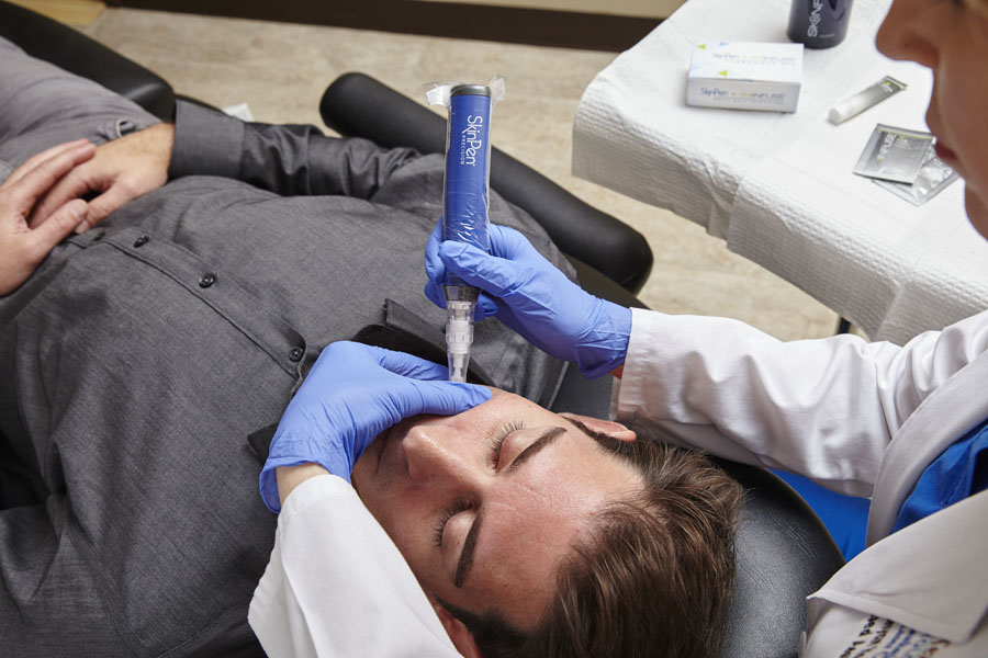 SkinPen Microneedling Treatment - Skinology Medical Aesthetics Clinic - London UK - 3