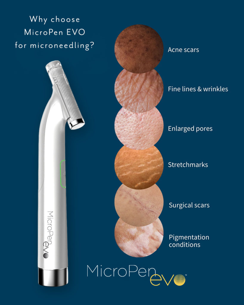 MicroPen Evo Microneedling Treatment - London UK - Skinology Medical Aesthetics - 1