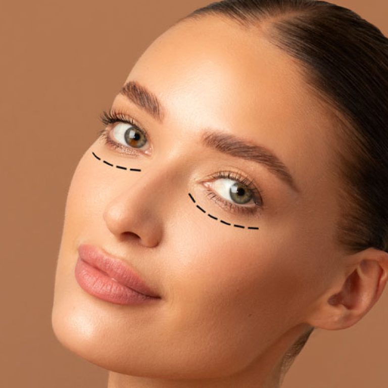 Polynucleotides Treatment - Skinology Medical Aesthetics Clinic - London UK - 1