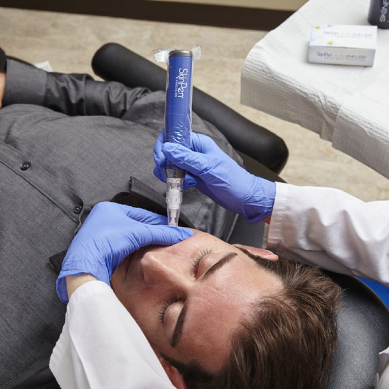 SkinPen Microneedling Treatment - Skinology Medical Aesthetics Clinic - London UK - 3